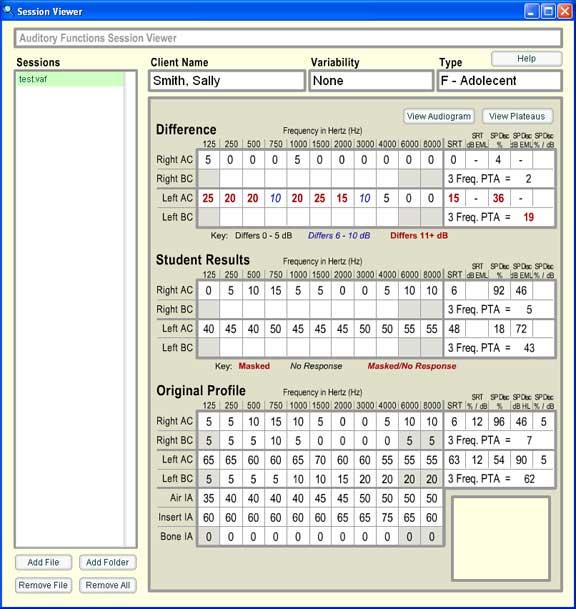 virtual audiometer session viewer